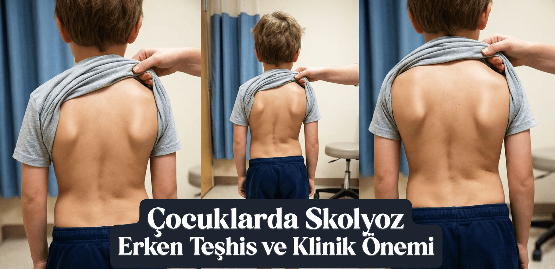 Çocuklarda Skolyoz: Erken Teşhis ve Klinik Önemi